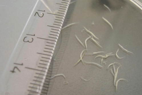 kako odstraniti pinworms pri otroku