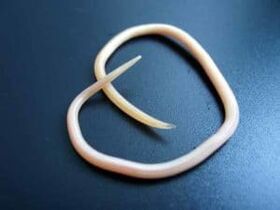 Človeški okrogli črv, pridobljen iz telesa