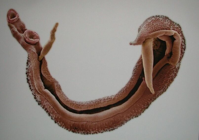 Schistosomi so nevaren parazit v človeški krvi