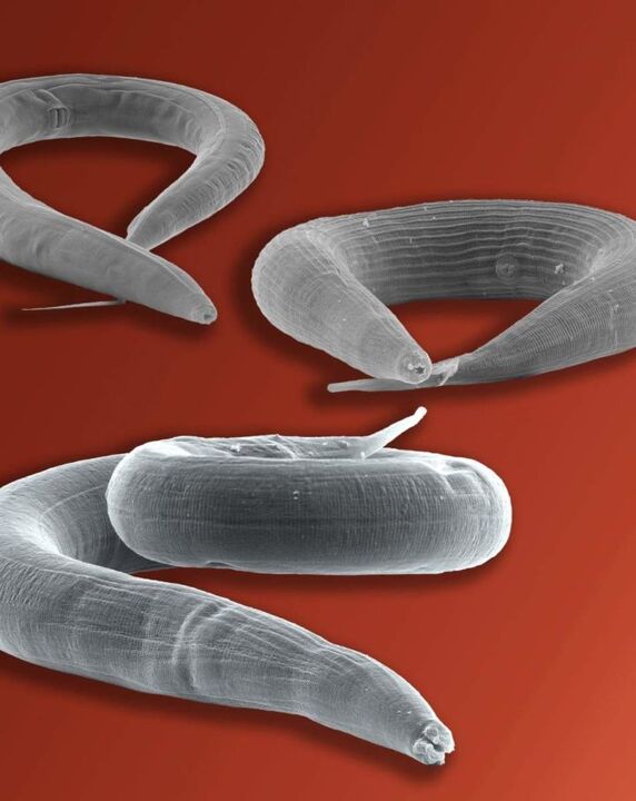 parazit pinworm, ki živi v črevesju