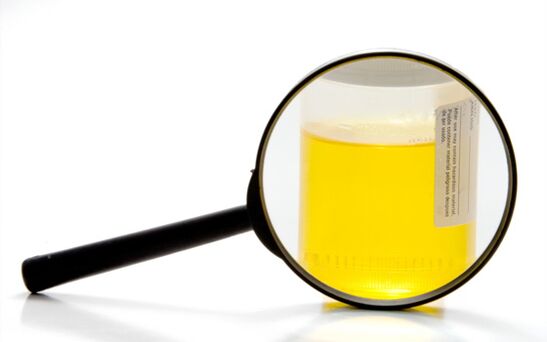 Pregled urina za diagnosticiranje shistosomiaze