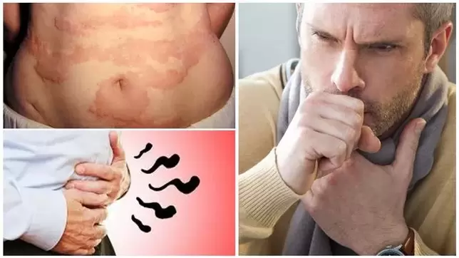Alergije, kašelj in napihnjenost so znaki poškodbe telesa s črvi