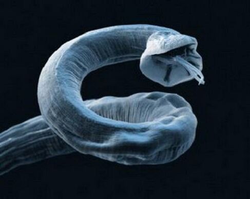črv iz človeškega telesa, kako odstraniti