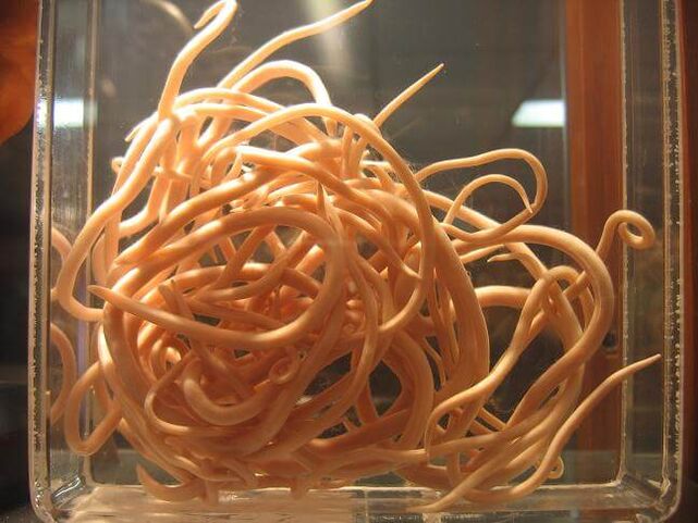 Okrogli črvi so črvi, ki spadajo v razred ogorčic. 