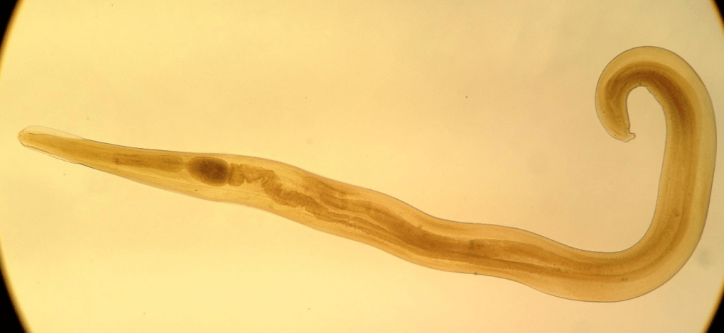 Pinworm je pogost parazit pri otrocih. 